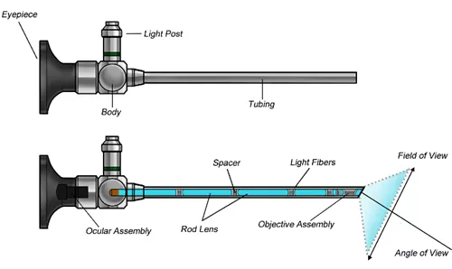 Classification and Application of Endoscope